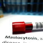 Mastositoz