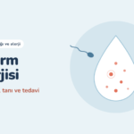 Sperm Alerjisi Nedir? Eşime Alerjim Olabilir mi?